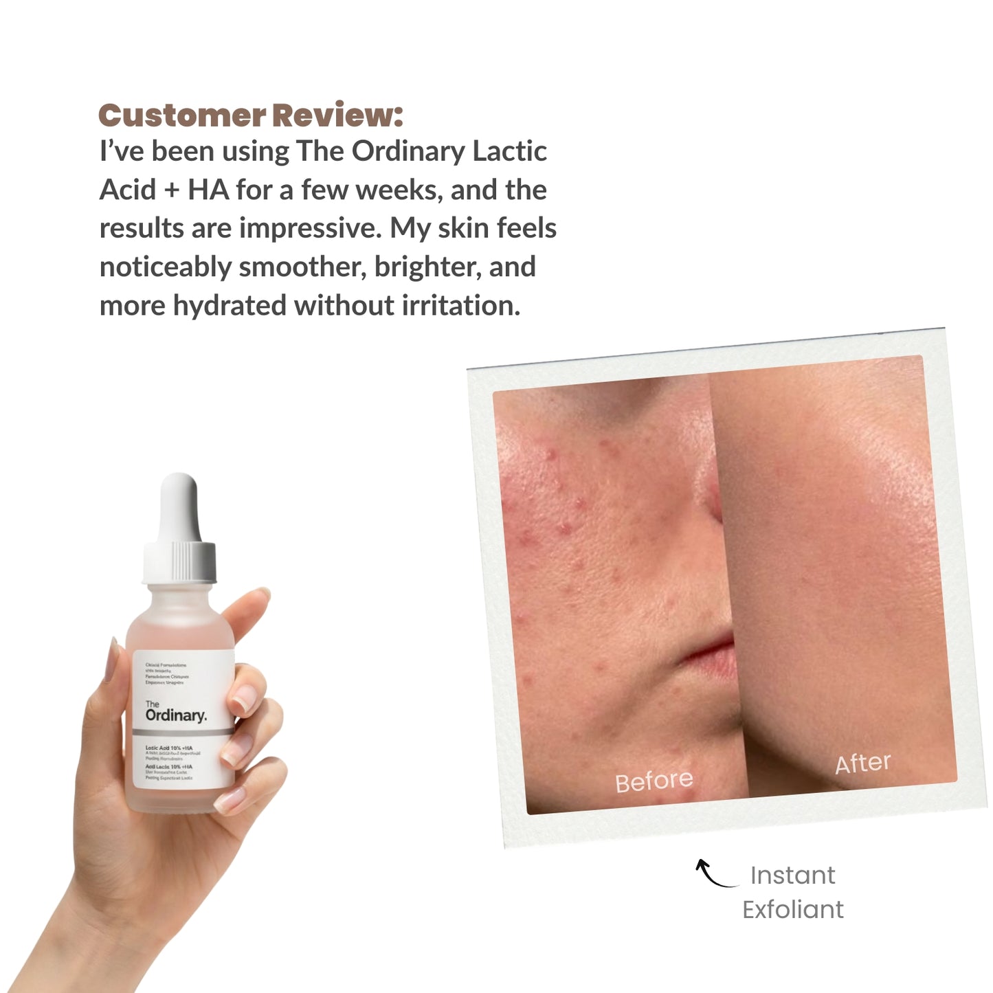 The Ordinary-Lactic Acid 5% + Hyaluronic Acid 2%
