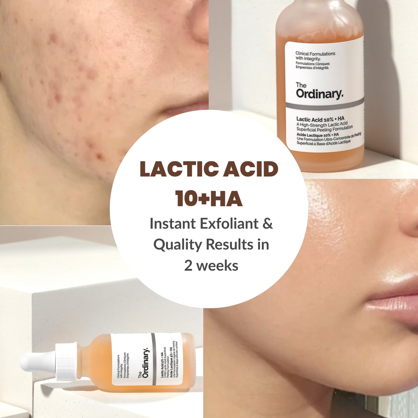 The Ordinary-Lactic Acid 5% + Hyaluronic Acid 2%
